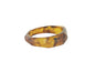PULSEIRA ACO