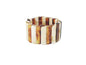 PULSEIRA ACO