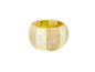 PULSEIRA ACO