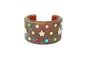 PULSEIRA ACO