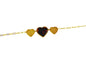 PULSEIRA ACO